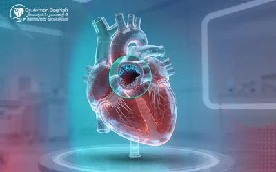 علاج ضيق الصمام الرئوي